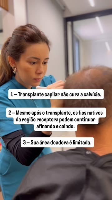 Posso ser sincera?

1 — Transplante capilar não cura a calvície.
Ele redistribui fios da área doador