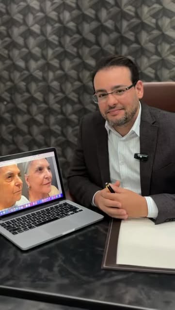 O Lifting de Face e Pescoço e a Blefaroplastia Estruturada comumente são realizadas em associação. O