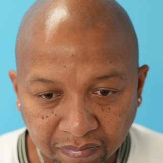 Today marks a powerful milestone for my client. After battling cancer and enduring the toll of chemo