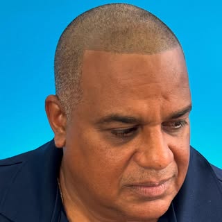 This is my client Roger. 
He wanted to enhance his hairline by adding density and creating a subtle 