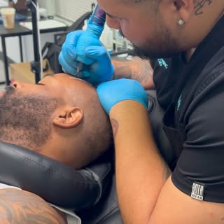Any stage of hair loss.
Results after the first session.
Scalp Micropigmentation isn’t a cover-up—it
