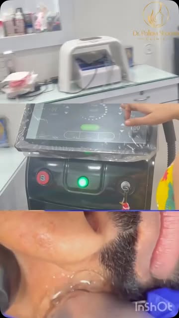 #drpallavisharmadadri #beardshaping #beardshapinglasertreatment #mengrooming #dadri