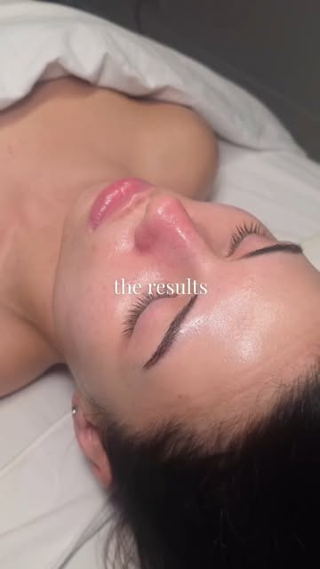 The process → the glow ✨

BELA MD+ combines exfoliation, deep cleansing, targeted serum infusion + h
