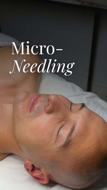 Microneeling, backed by your skin's natural healing response.

Controlled micro-channels stimulate c
