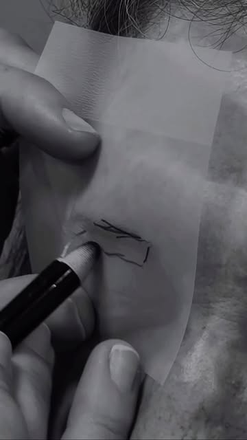 A reconstrução da sobrancelha exige uma análise individualizada da anatomia facial, respeitando prop