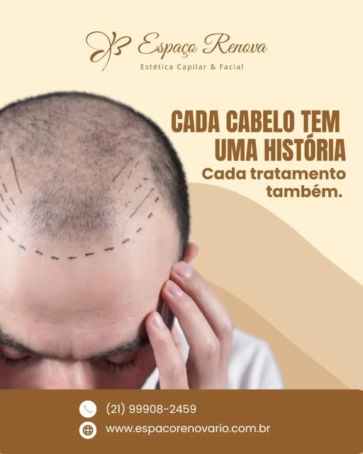 No Espaço Renova, a gente entende que a calvície vai muito além da estética. É sobre se olhar no esp