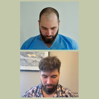 Antes y después
