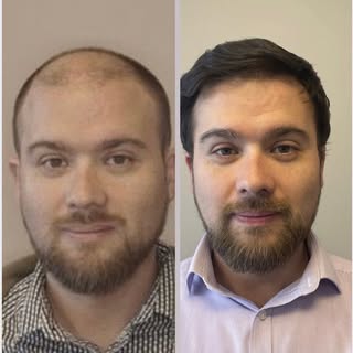 Antes y después. Que cambio más impactante!!