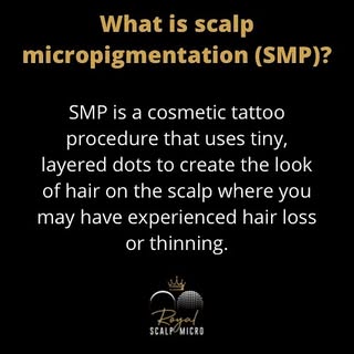 What is scalp micropigmentation?

It’s the process in which we recreate the look of a fuller, more y
