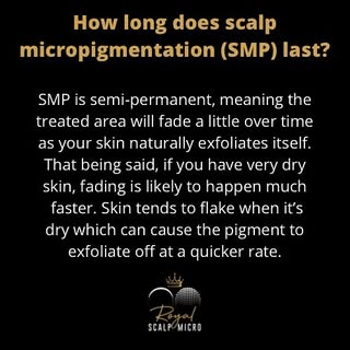 Scalp micropigmentation is an investment but it is so worth it to have amazing, long-lasting results