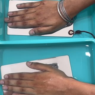 💧 Say goodbye to excessive sweating with Iontophoresis Treatment!

If sweaty hands, feet, or undera