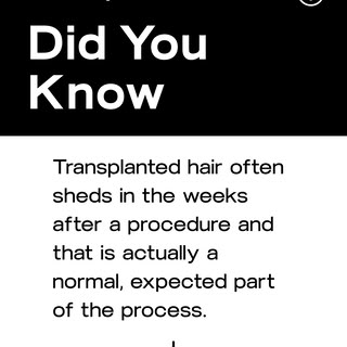 Did you know that transplanted hair often falls out before it grows back?

It sounds alarming, but s