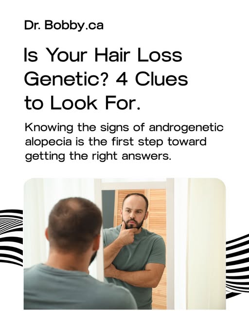 Genetic hair loss is the most common type affecting both men and women. But how do you know if that 