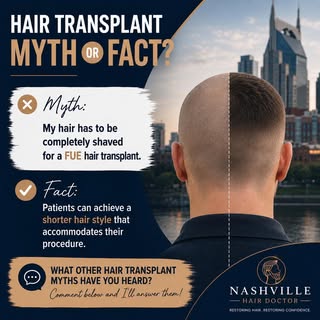 💭 HAIR TRANSPLANT MYTH OR FACT?

❌ Myth: You have to completely shave your head for a FUE hair tran