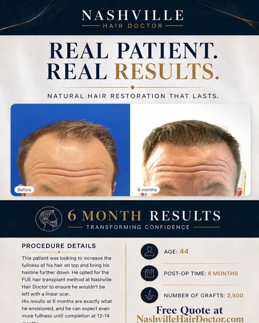 Real patient. Real progress. 🙌

At just 6 months, this patient is already seeing a fuller, stronger