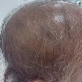 Latest update!!!!!
Consistency is the key 🗝 
Together, we can help restore your hair on the safest,