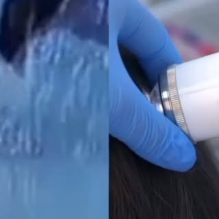 What you see in the mirror isn’t always the full picture. 👀🔬

Your scalp can appear completely nor