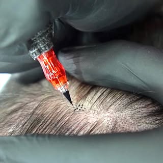Sabia que não precisa raspar a cabeça pra fazer a micropigmentação com intuito de melhorar a densida