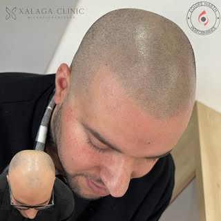 Cansado de usar minoxidil? 😞

Campeão em Micro Capilar 🏆

Entre em contato e saiba mais 👈🏻

Info