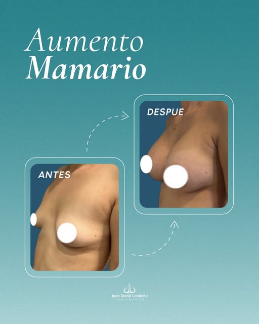 Hay cambios que no buscan transformar quién eres, sino ayudarte a sentirte más cómoda y segura con t
