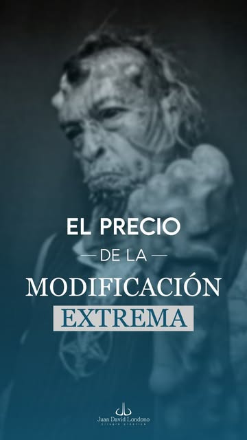 ¿Cuál es el límite entre cumplir un deseo estético y poner en riesgo tu vida? 👁️🛑

Escuchar casos 