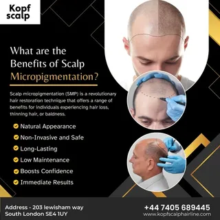 🌟 Transform your look and boost your confidence with Scalp Micropigmentation (SMP)! 🌟

SMP is a re