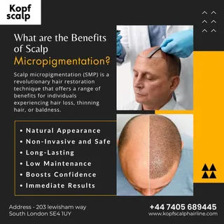 ✨ Restore your confidence with Scalp Micropigmentation (SMP)!
✔ Natural Look
✔ Safe & Non-Invasive
✔