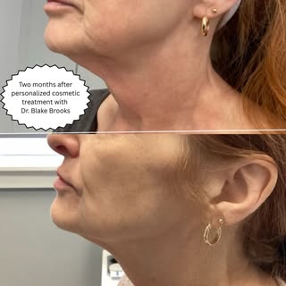This lovely patient came to see Dr. Blake Brooks at Fairfield Dermatology for a cosmetic consultatio