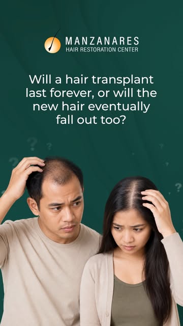 One of the biggest questions we get is: "If I'm already losing my hair, won't the transplanted hair 