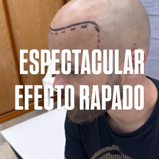 🔥 DE ESTO… A ESTO 👀
Cuando ves un antes y después así, sobran las explicaciones. La clave no es si