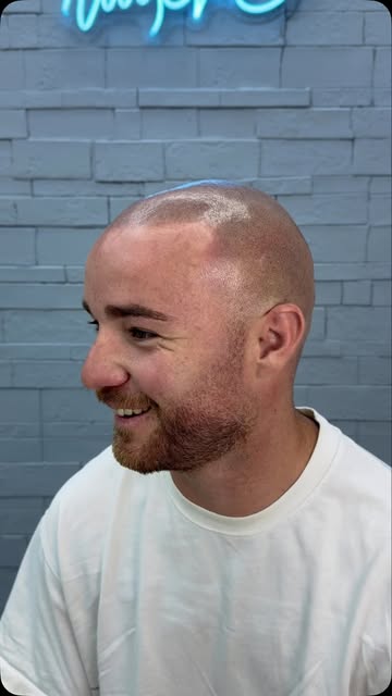 ✨ Ver la sonrisa de un cliente con su resultado recién hecho… 

Micropigmentación capilar diseñada p