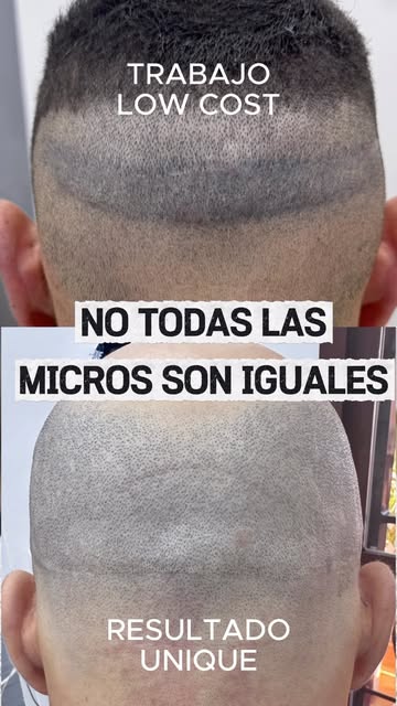 Sé que lo decimos muchas veces, pero es que realmente es importante: no todas las micro capilares so