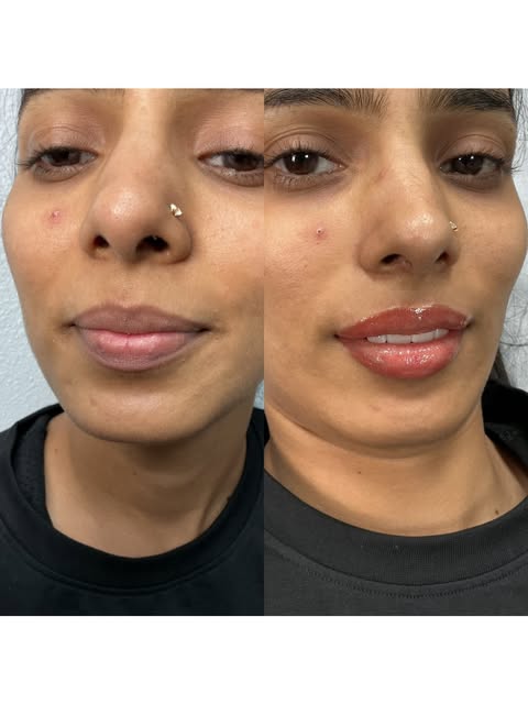 Just a few before and after pics. These lovely ladies decided they wanted to make their daily routin