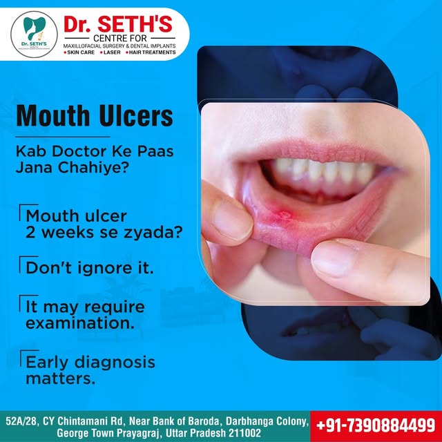Don't ignore persistent mouth ulcers! 🩺

If a mouth ulcer lasts longer than 2 weeks, it requires pr