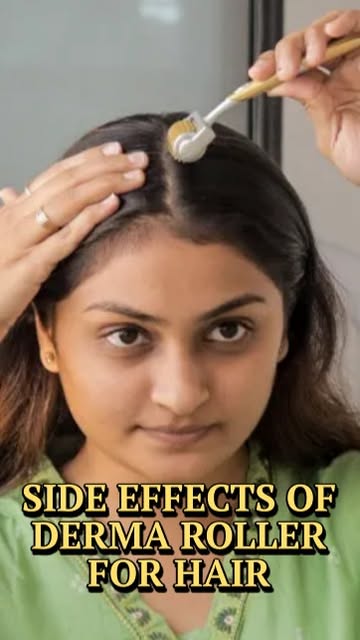 Side Effects of Using a Derma Roller for Hair Loss | Scalp Damage & Risks Explained | Dr. Shahid Sha