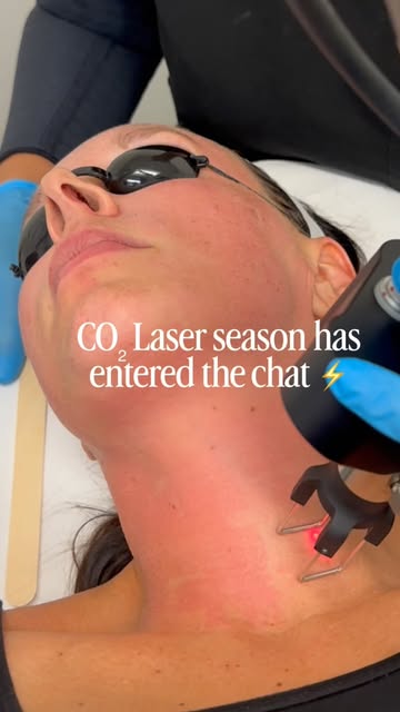 A little trauma, but make it controlled🔥

CoolPeel CO₂ creates controlled thermal injury to stimula