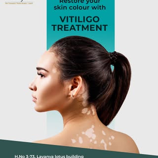 Vitiligo doesn’t define your beauty — confidence does ✨

At Ameyaa Clinic, we offer advanced Vitilig