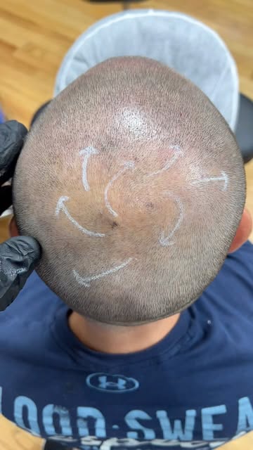 🆘want to learn #scalpmicropigmentation and learn the leading #hairloss #solution .Join us  December