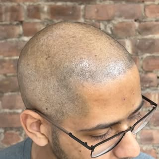 No filter needed☝🏽..Get real results by Artist 🎨 @jonathangerow #smp #scalpmicropigmentation #hair