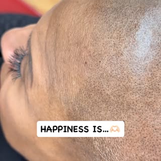 2 sessions of bliss #smp #scalpmicropigmentation #hairloss #balding #pmu #alopecianbeauty #women