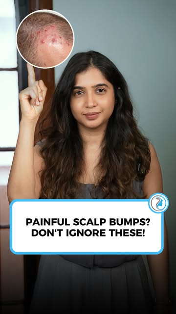 Are you getting painful pimples or boils on your scalp? These bumps can be itchy, tender, and frustr