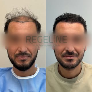 Incredible progress after almost a year – amazing results!