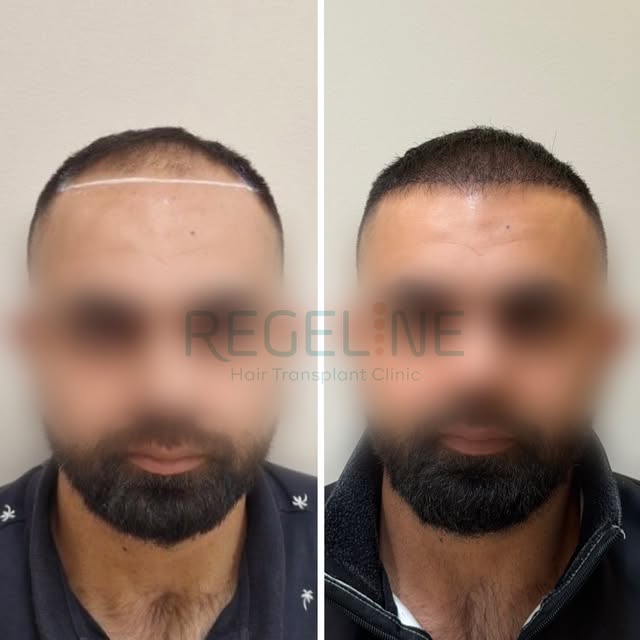A result worth waiting for.

Here’s how things are looking after only 4 months.