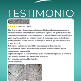 "Solo llevo un mes… y ya están creciendo nuevos pelos."

No lo decimos nosotros. Lo cuenta una de nu