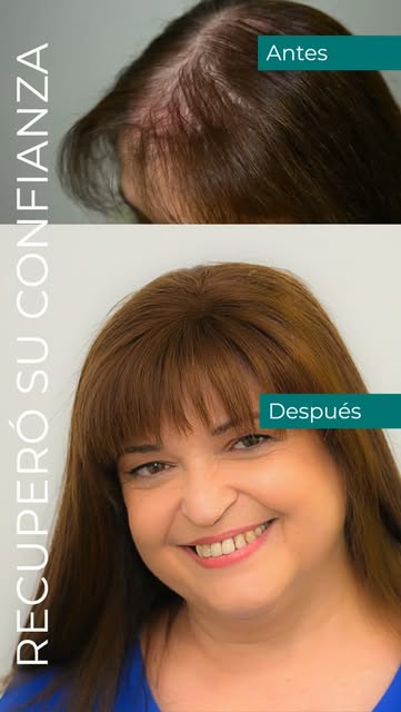 Un antes y un después que va más allá del cabello.

Con su Sistema de Integración Capilar, Mariam ha