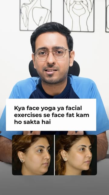 Can face yoga replace a facelift? Plastic surgeon reveals the TRUTH! #facelift #faceyoga #cosmeticsu