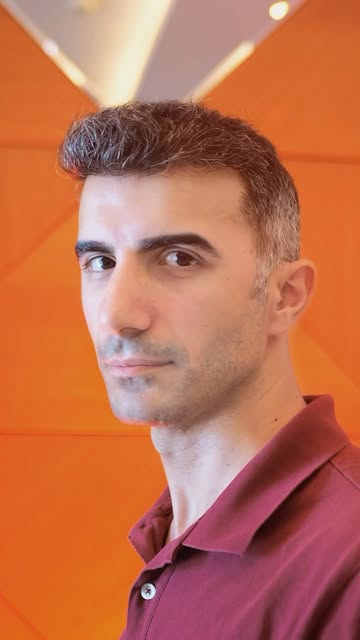 A natural hair transplant result starts with the right planning.

A carefully designed hairline, bal