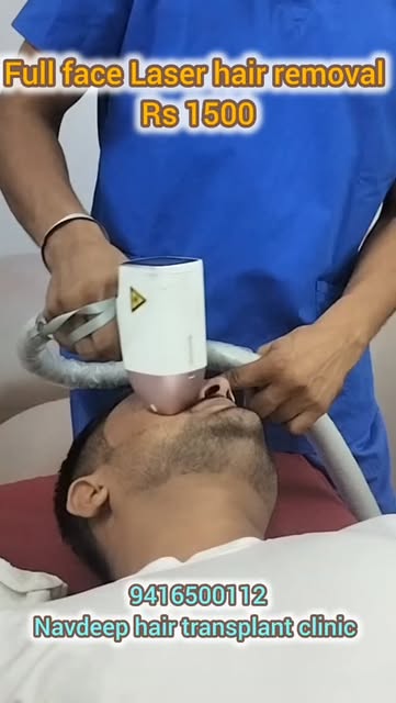 Special Limited-Time Offer: Full Face Laser Hair Removal at Just ₹1,500!
Say goodbye to unwanted fac