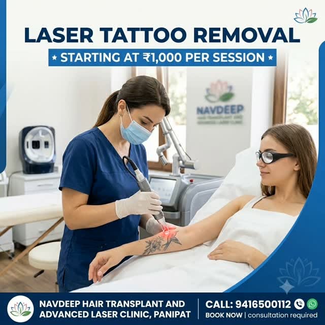 Got tattoo regret? Don’t let unwanted ink hold you back! ✨
At Navdeep Hair Transplant & Advanced Las
