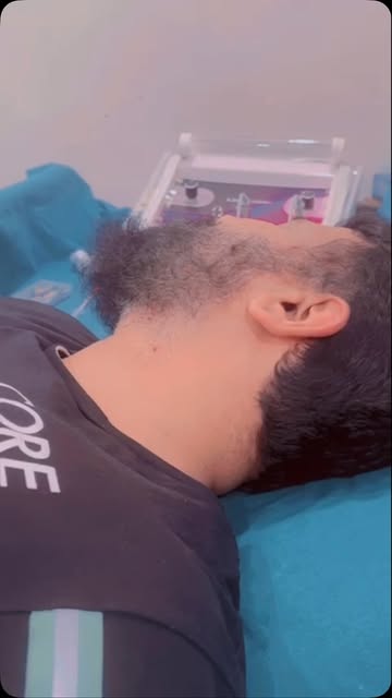 ✨ Mole Removal with RF Cautery ✨

A simple, precise and minimally invasive approach to remove unwant